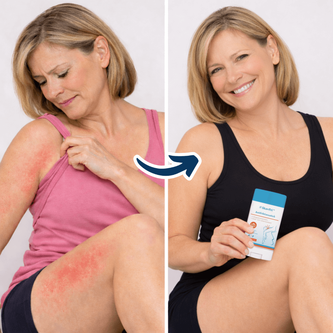 SkavFri™ Antifriktionsstick