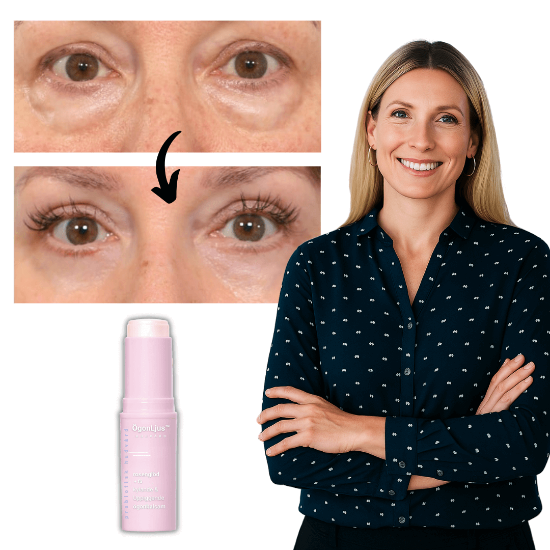 ÖgonLjus™ Ögonbalsam